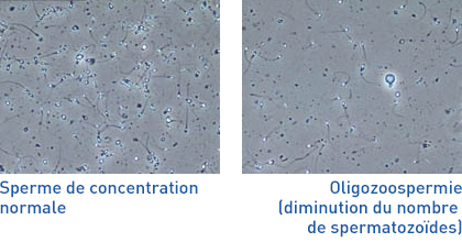 comparaison sperme